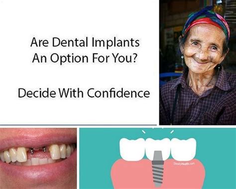 Improve Your Smile With Dentalimplants Whether Youve Lost Teeth Due