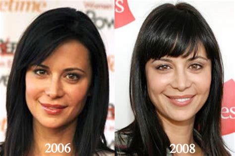 Catherine Bell Plastic Surgery Before and After Photos - Latest Plastic Surgery Gossip And News ...