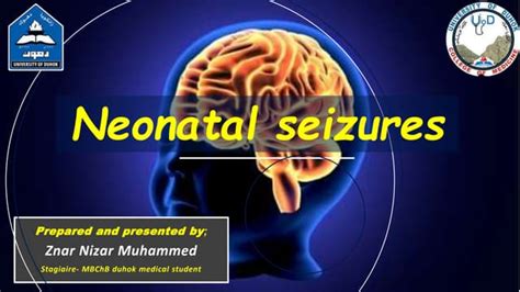 Neonatal seizures- | PPT