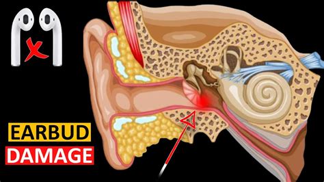 How Earbuds Damage Your Ears YouTube