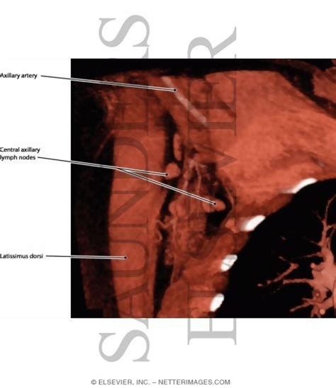 Lymph Nodes of the Axilla