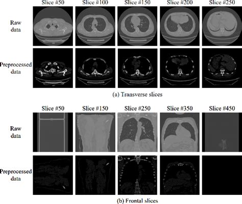 Figure 2 From Rib Segmentation And Sequence Labeling Via Biaxial