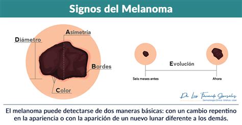 23 De Mayo Día Mundial Del Melanoma