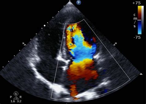 What Does A Cardiovascular Sonographer Do