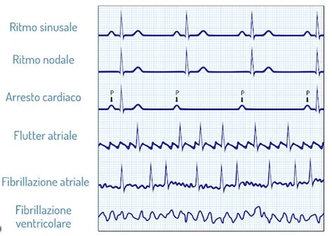 Come Leggere Un ECG Peer4Med