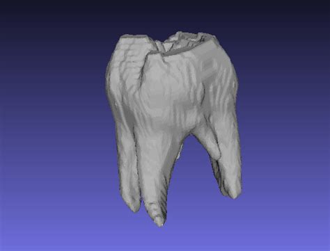 Free 3d File Tooth From The Fields 🦷・3d Printable Model To Download・cults