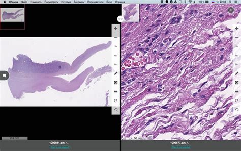 Pathology Puzzles Страница 3 из 5 Pathology Puzzles