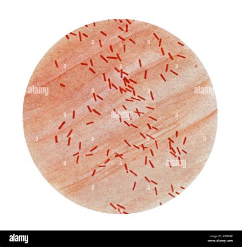 Escherichia Coli Gram Stain