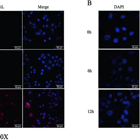 Exosome Labelling And Uptake Assay Uptake Of Exosomes By HK2 Cells