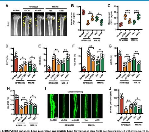 Figure 1 From M6a Reader Hnrnpa2b1 Drives Multiple Myeloma Osteolytic