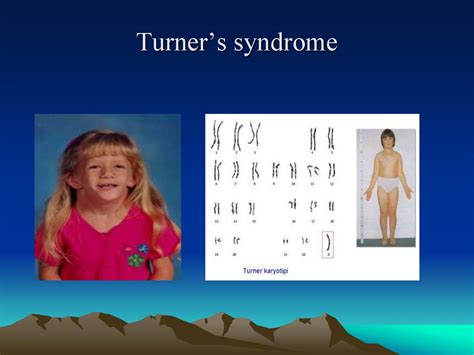 Genetics Genotype Online Presentation