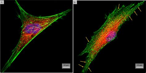 Confocal Fluorescent Micrographs Of Hmscs Stained For Paxilin Red