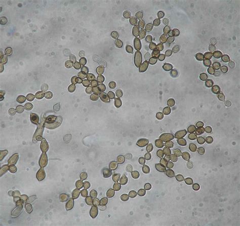 Atlas Micologia Cladosporium Sphaerospermum