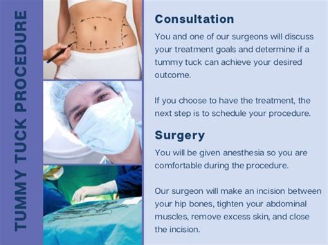 Best Tummy Tuck Abdominoplasty Lexington Ky Plastic Surgeons Of Lexington