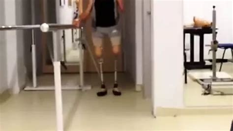 Free Triple Amputee Porn Videos XHamster