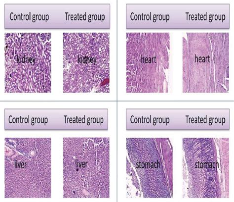 Histopathology slides of heart, liver, kidney and stomach, control ...