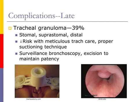 Ppt Pediatric Tracheostomy Powerpoint Presentation Free Download