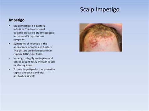 What are Common Causes of A Sore Scalp?