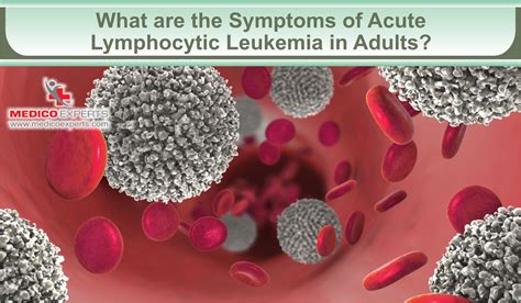 Acute Leukemia In Adults A Closer Look