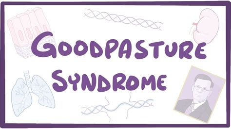 Goodpasture syndrome - causes, symptoms, diagnosis, treatment, pathology - YouTube