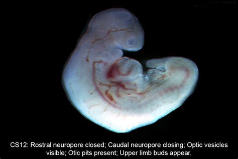 Human Embryo Carnegie Stages