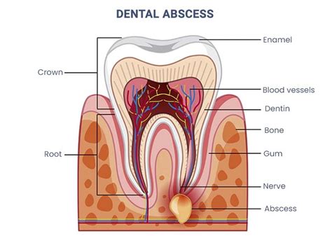 Emergency Dentist