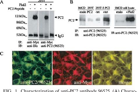 Figure 1 From Native Polycystin 2 Functions As A Plasma Membrane Ca 2