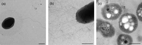 Electron Micrographs Of Negatively Stained Aqueous Uranyl Acetate