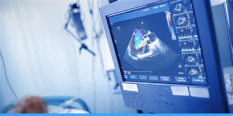 5 Difference Between Ekg And Echocardiogram Myconciergemd