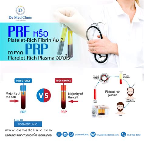 Prf หรือ Platelet Rich Fibrin คืออะไร Demedclinic