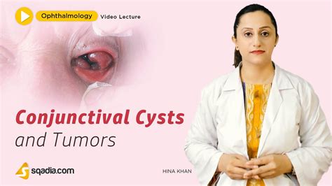 Palpebral Conjunctival Cyst