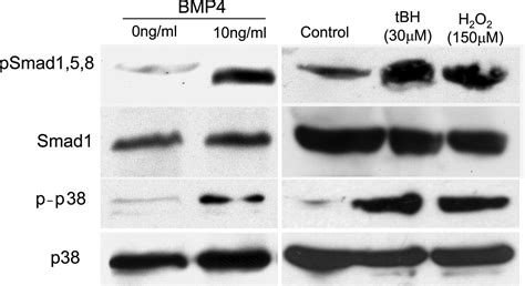 Bmp Mediates Oxidative Stress Induced Retinal Pigment Epithelial Cell