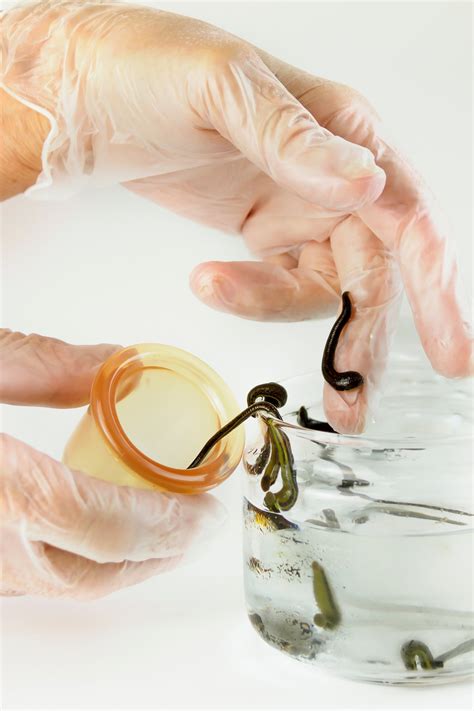 leeches in florida 6