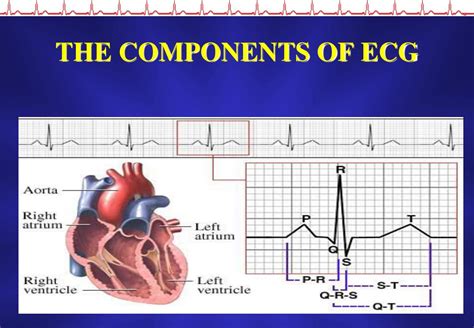 Components Of A Ecg