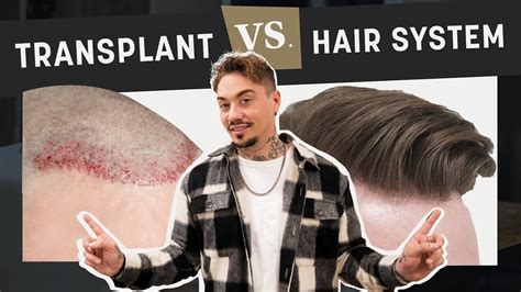 Hair Transplant Vs Hairsystem These Are The Pros And Cons Youtube