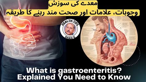 What Is Gastroenteritis Explained You Need To Know YouTube