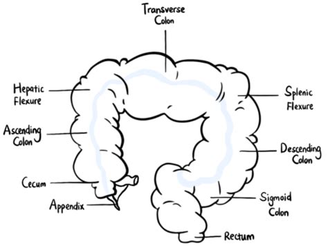 What's Colon Cancer | Colon Detective