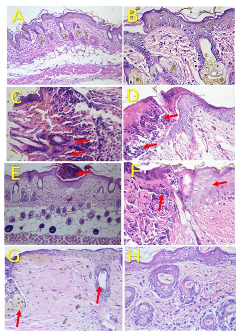 Histological Analysis Of Skin Tissue Healing Photomicrographs Of