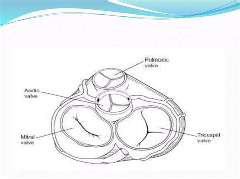 Tricuspid Valve Disease Ppt