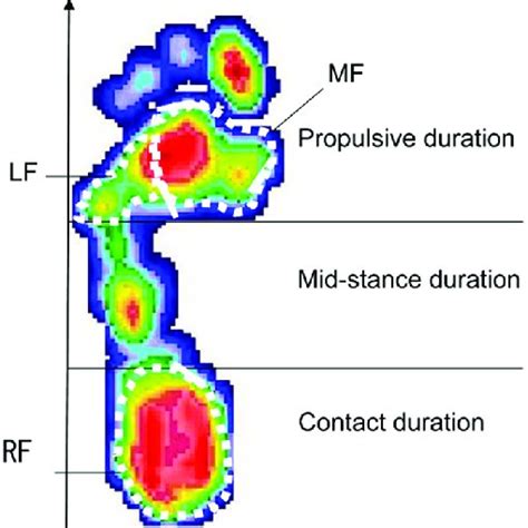 Plantar Pressure Distribution Lf Lateral Forefoot Mf Medial