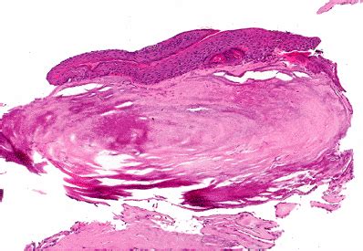 Tympanic Membrane Histology