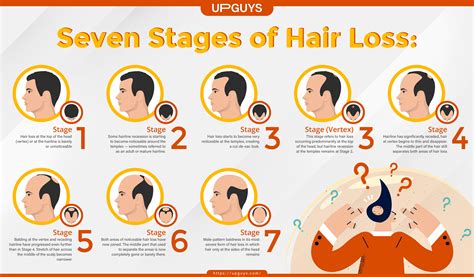 The Seven Stages of Hair Loss | UPGUYS