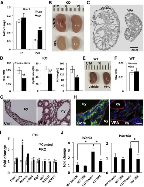 The Hdaci Vpa Suppresses Disease Progression In Arl B Flox Flox