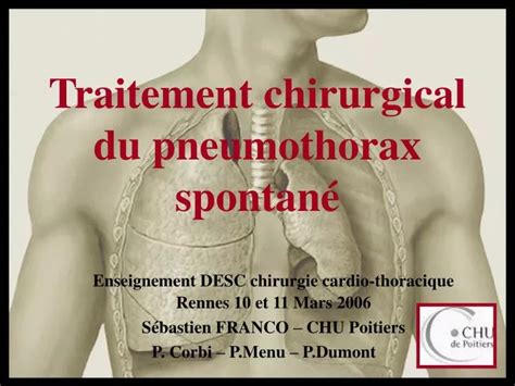 Ppt Traitement Chirurgical Du Pneumothorax Spontan Powerpoint