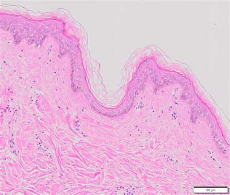 Human Skin Tissue Normal Ffpe Sections