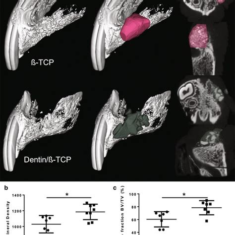 Histological Representation Of The Repaired Alveolar Clefts A Coronal