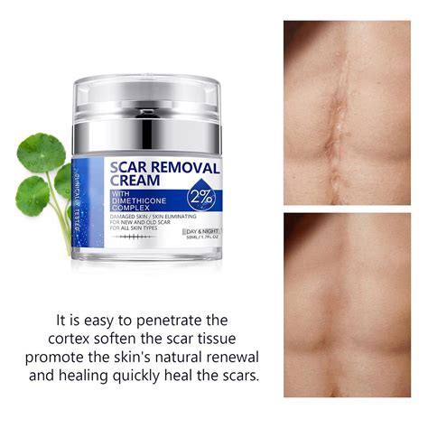 50ml Skin Repair Stretch Mark & Scar Removal Cream - Effective Surgery