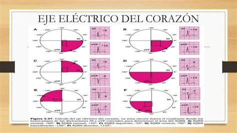 Electrocardiograma Basico Diapos PPT