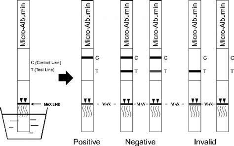 Micro Detecci N Cualitativa Microalbuminuria De La Varilla Graduada