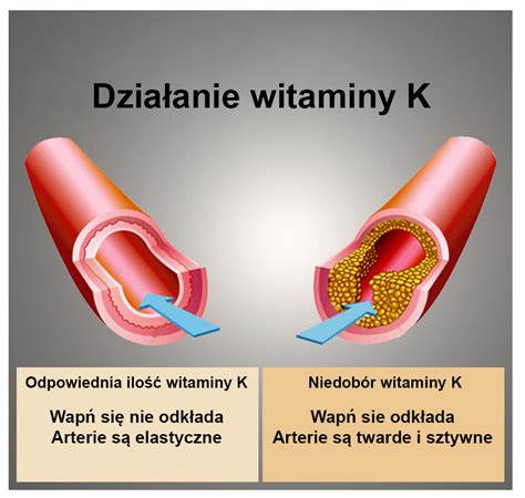 Niedobór witaminy K jakie są jego objawy Jak mu przeciwdziałać Blog